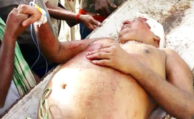 क्लिनिक के सामने चिकित्सक को मारी तीन गोली, हवाई फायरिंग करते हुए फरार हुए अपराधी, सड़क जाम