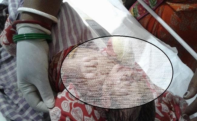 शर्मसार हुई ममता, कूड़ेदान में फेंकी मिली नवजात, नेवले बना रहे थे निवाला