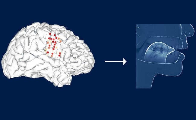 मस्तिष्क के संकेतों को ट्रांसक्रिप्ट करेगी स्पीच डिकोडर टेक्नोलॉजी