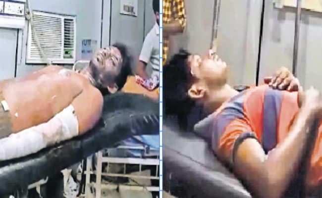 चूल्हे के सामने शरीर पर किया बॉडी स्प्रे, लगी आग, तीन छात्र हुए घायल