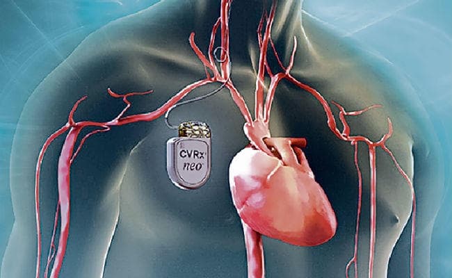 हार्ट फेल को रोकेगी ये डिवाइस