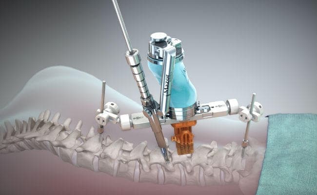 रीढ़ के दर्दरहित और कम खर्चीले ऑपरेशन के लिए आईआईटी के शोधकर्ताओं ने बनाया रोबोट