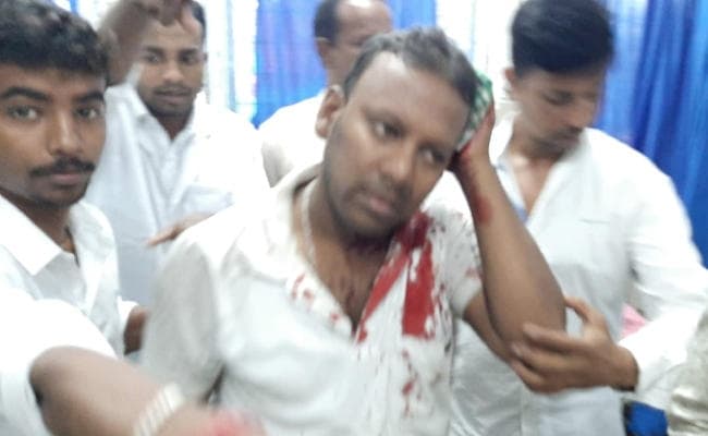 West Bengal : बंद के दौरान टीटागढ़ में मंडल अध्यक्ष समेत कई भाजपा समर्थक लहूलुहान, पुलिस पर हमला