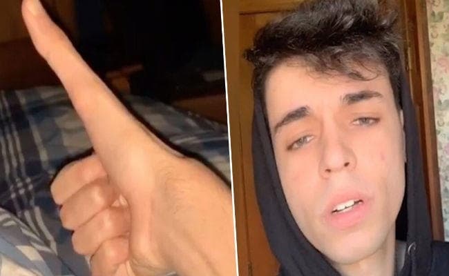 OMG! 5 इंच लंबा अंगूठा? TikTok पर Viral हुआ Video