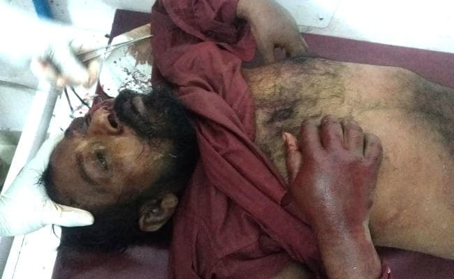 झारखंड में मॉब लिंचिंग, बच्चा चोरी की अफवाह पर एक व्यक्ति की पिटाई से मौत, 5 गिरफ्तार