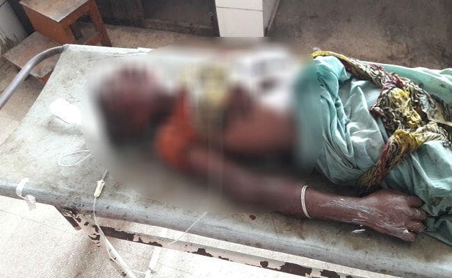 60 वर्षीय वृद्ध महिला को सदर अस्पताल में छोड़ा, दोनों आंख में लगा कीड़ा