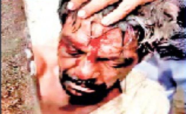 पश्‍चिम बंगाल में मॉब लिंचिंग: बच्चा चोर के संदेह में पीट पीटकर हत्या, बिजली के खंभे में बांधकर बुरी तरह पीटा