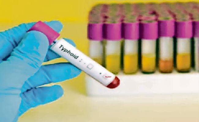 टायफॉयड से हो सकता है डीएनए प्रभावित
