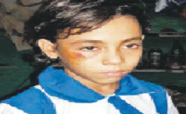 लूडो खेलने मशगूल रहे शिक्षक मारपीट में जख्मी हुई बच्ची