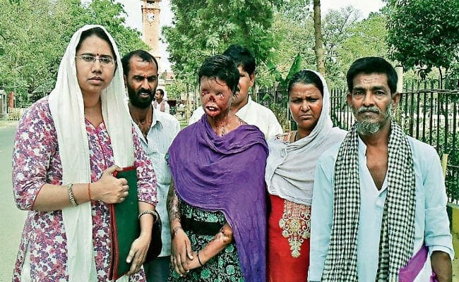 #AcidAttackSurvivor : बदलनी होगी पितृसत्तात्मक सोच, सोनी के साथ चार साल पहले हुआ ये