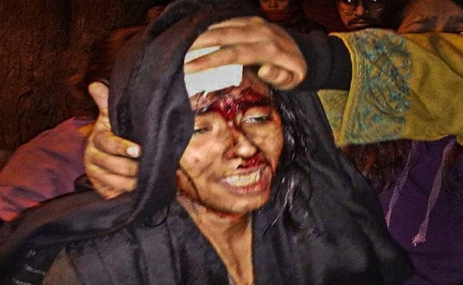 JNU Campus में छात्र संघ और एबीवीपी के बीच मारपीट में अध्यक्ष आईशी घोष बुरी तरह घायल