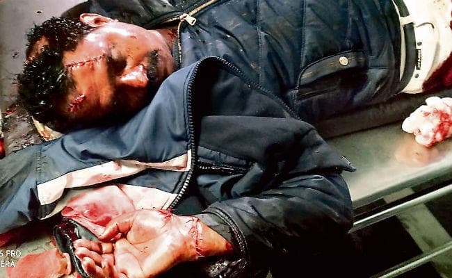 रांची : कांके में कांग्रेस नेता पर फरसे से हमले के बाद पथराव व आगजनी, सड़क जाम