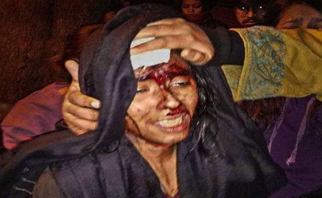 JNU Violence : आईशी घोष ने कहा- RSS, ABVP के गुंडों ने मेरी हत्या की कोशिश की