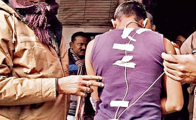 सिपाही भर्ती परीक्षा : नकलची अभ्यर्थी के कान में फंस गया ब्लूटुथ डिवाइस, करना होगा ऑपरेशन