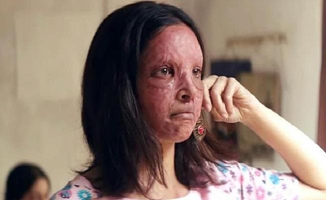 सोशल मीडिया पर फिल्म “छपाक” देखकर बोले दर्शक, इस फिल्म से सारे अवार्ड जीत जायेंगी दीपिका