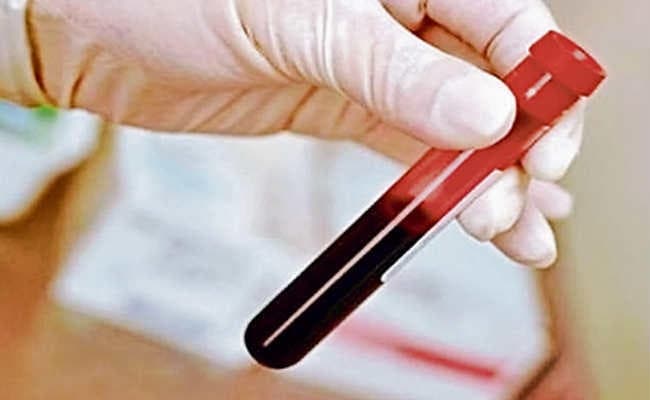 अवैध पैथोलॉजी घरों पर लगेंगे ताले