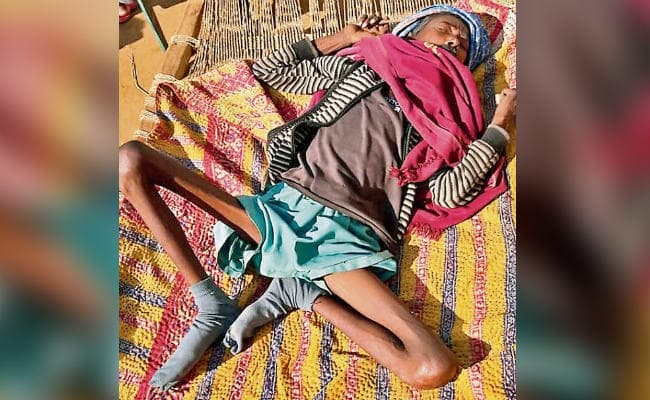 चतरा : हर दिन अपनी मौत की दुआ मांग रहा एतु गंझू