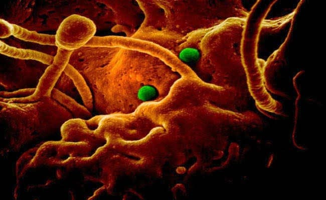 कोरोना : संदेह में म्यांमार का व्यक्ति भर्ती