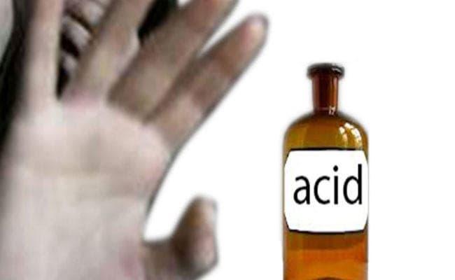 Acid Attack: छात्र ने सहपाठियों पर फेंका तेजाब, तीन छात्राओं समेत चार झुलसे