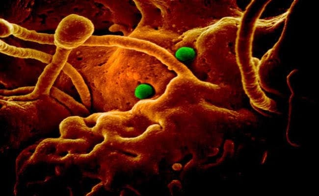 Corona virus : दक्षिण कोरिया में मामले बढ़े, इटली और ईरान ने उठाये ये कठोर कदम