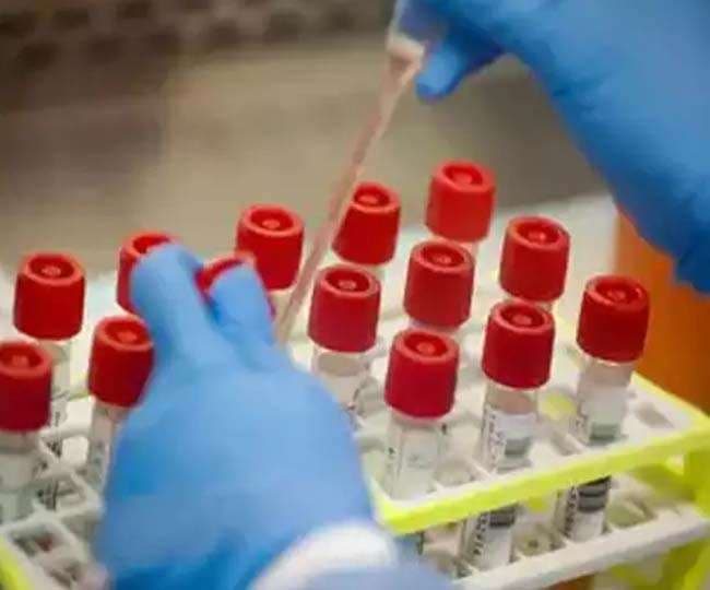 कोरोना टेस्ट के बाद ही होगा मरीजों का इलाज, रैपिड एंटी जॉन कीट से होगी जांच