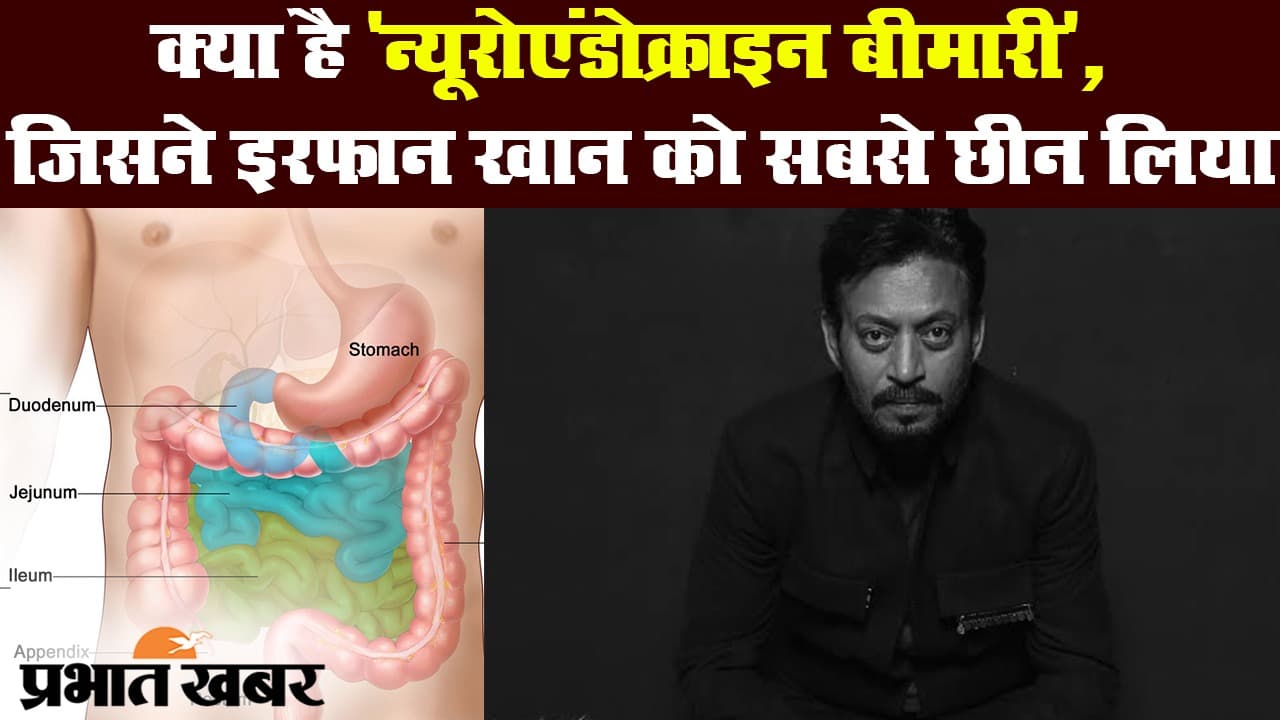 क्या है 'न्यूरोएंडोक्राइन ट्यूमर', जो Irfan Khan की मौत का कारण बना