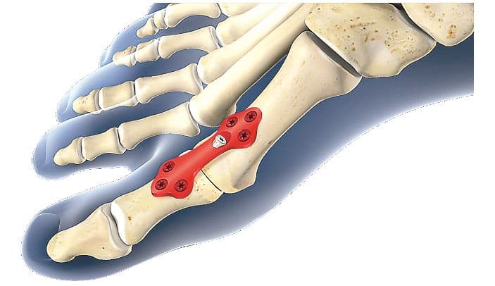 IRCTC/Indian Railways News: रिजर्वेशन की मांग पर अड़े गुर्जर, रेलवे लाइन पर प्रदर्शन जारी, कई ट्रेनों का बदला रुट