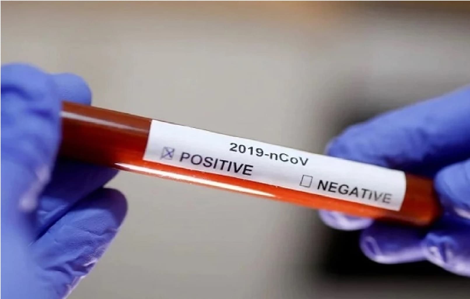 Coronavirus Jharkhand Update : रांची के हिंदपीढ़ी से कोरोना के 3 नये मामले, एक गढ़वा से, झारखंड में संक्रमितों की संख्या 49 हुई