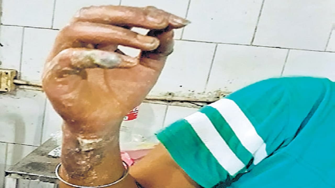 NCRB Report : महिलाओं के खिलाफ अपराध के 4 लाख से अधिक मामले दर्ज, बंगाल में एसिड अटैक की सबसे अधिक घटनाएं