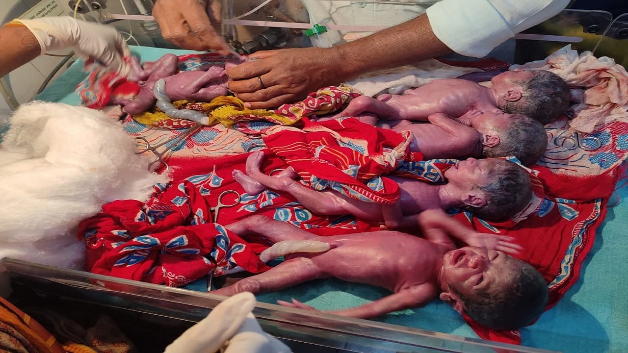 Bihar News: डॉक्टरों को मिली बड़ी सफलता, सीवान में एक महिला ने पांच बच्चों को दिया जन्म, सभी स्वस्थ