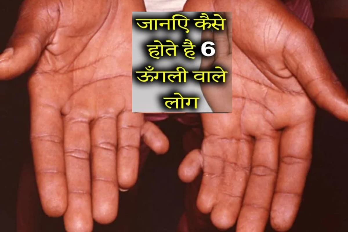 6 उंगलियों वाले लोग होते हैं भाग्यशाली, जानिए इनकी खासियत