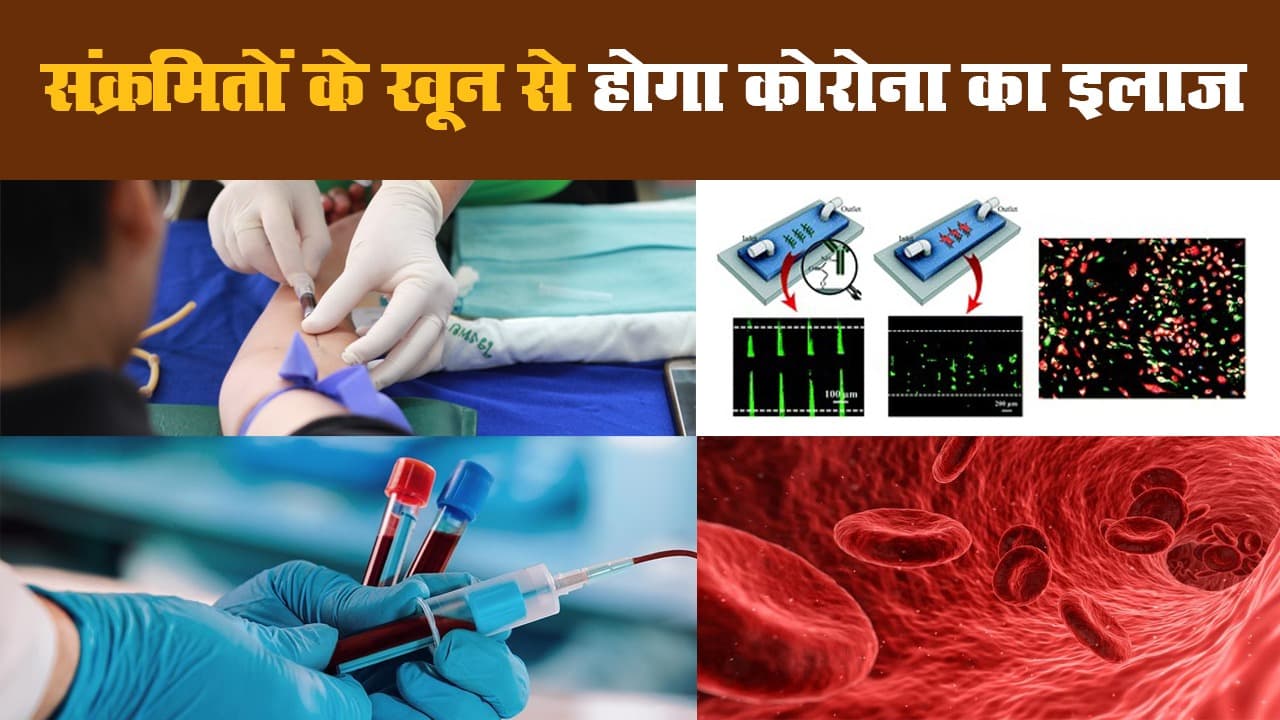 Coronavirus: संक्रमितों के खून से होगा कोरोना का इलाज