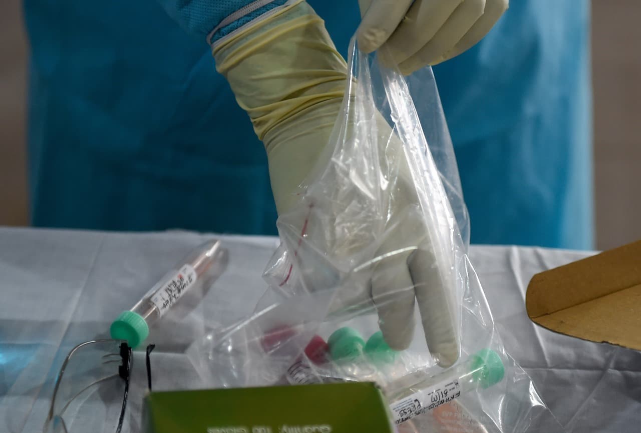 Coronavirus Lockdown Jharkhand update: आज  हुए 182 कोरोना वायरस टेस्ट, सारे रिपोर्ट निगेटिव