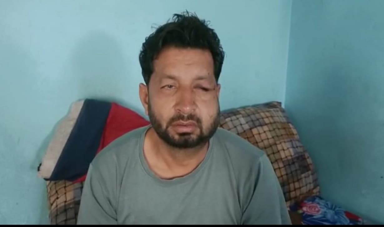Aligarh: टशनबाजी में दबंगों ने युवक का किया अपहरण, नंगा कर बनाया वीडियो, मुकदमा दर्ज Aligarh: टशनबाजी में दबंगों ने युवक का किया अपहरण, नंगा कर बनाया वीडियो, मुकदमा दर्ज