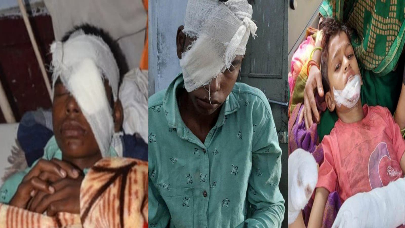 अलीगढ़ में द‍िवाली में जरा सी लापरवाही से आतिशबाजी में कई घायल, पटाखा जलाने को लेकर कई जगह मारपीट