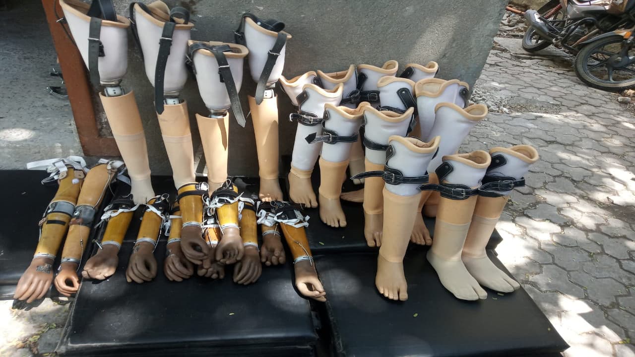 लातेहार के 71 दिव्यांग जनों को मिलेगा कृत्रिम अंग, 24 मार्च से विभिन्न प्रखंड़ों में शुरू होगा प्रोग्राम