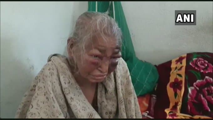 Bengal Chunav 2021 : TMC समर्थकों ने BJP कार्यकर्ता की मां को बुरी तरह पीटा! बोलीं शाजिया इल्मी -मां जी हम शर्मिंदा...