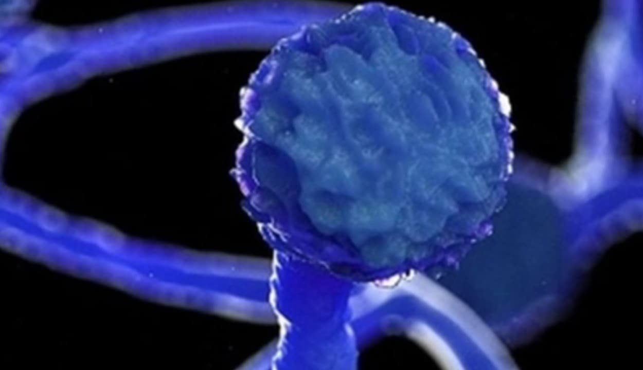 भारत में अब येलो फंगस ने दी दस्तक, ब्लैक और व्हाइट से है ज्यादा खतरानाक, गाजियाबाद में मिला पहला मरीज