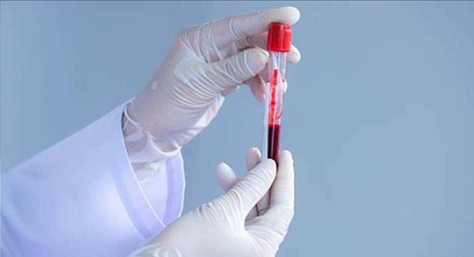 Corona Vaccine Update : कोरोना वैक्सीन लेने के 28 दिनों तक नहीं कर सकते ब्लड डोनेट, जानें क्या है मामला
