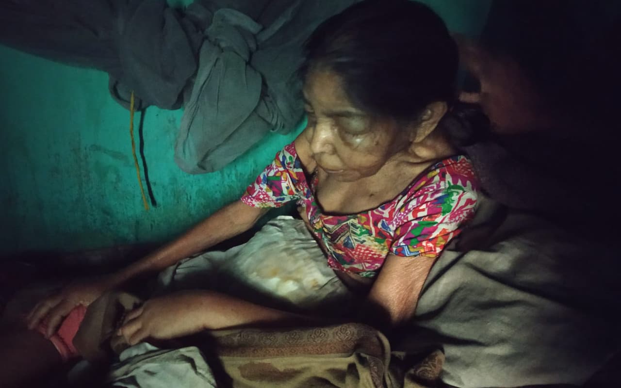 Jharkhand News: चक्रधरपुर राजघराने की बहू अंधेरे कमरे में बीमारी से लड़ने को मजबूर, जानें कारण