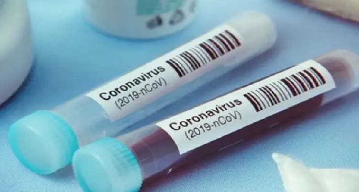 भोजपुर में मिला एक और कोरोना पॉजिटिव, पूरा इलाका सील