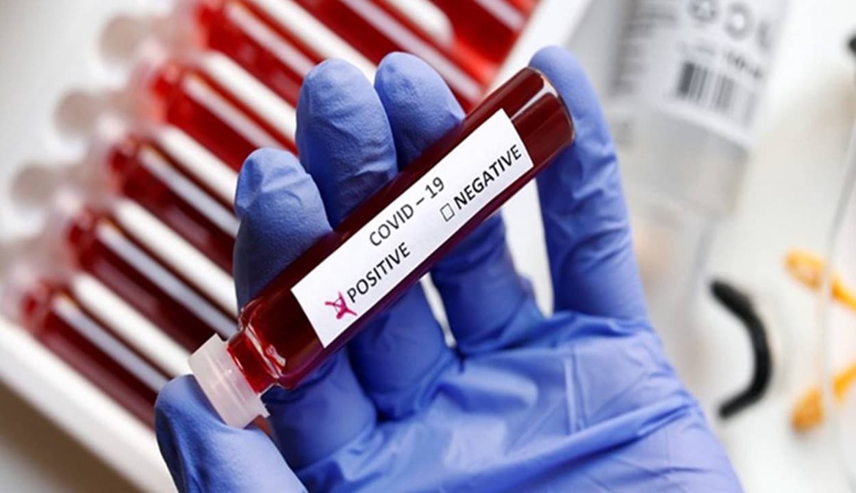 Covid-19 : कोलकाता में तेजी फैल रहा है कोरोना संक्रमण, एक दिन में 65 संक्रमित, 9 लोगों की हुई मौत