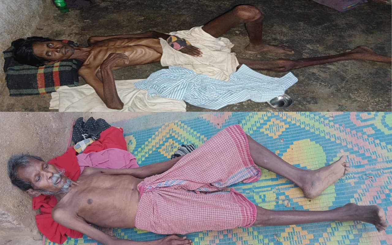 झारखंड : पूर्वी सिंहभूम के चाकुलिया में 2 सबर ग्रामीण का देखें हाल, चलने-फिरने से भी है लाचार