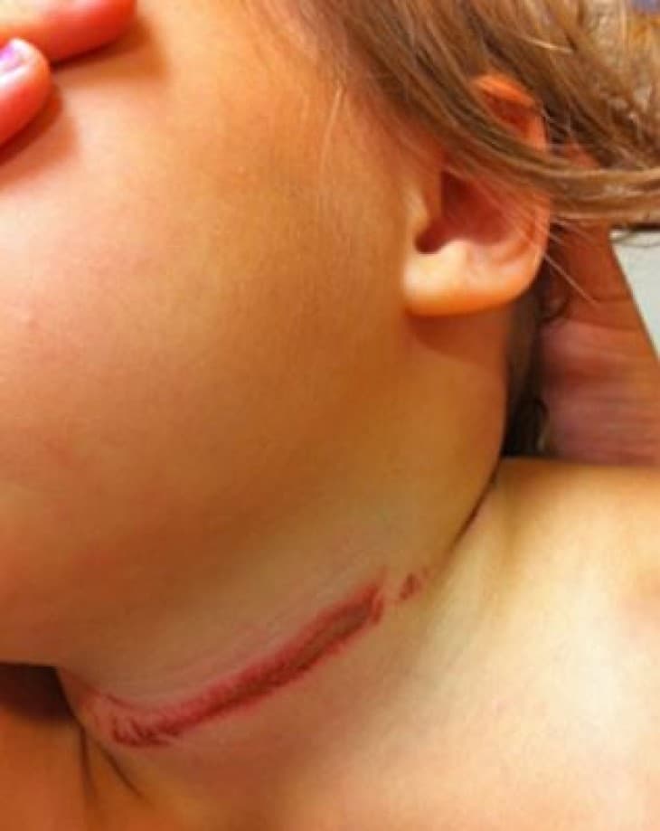 अरेराज में मासूम बच्ची की गला दबाकर हत्या