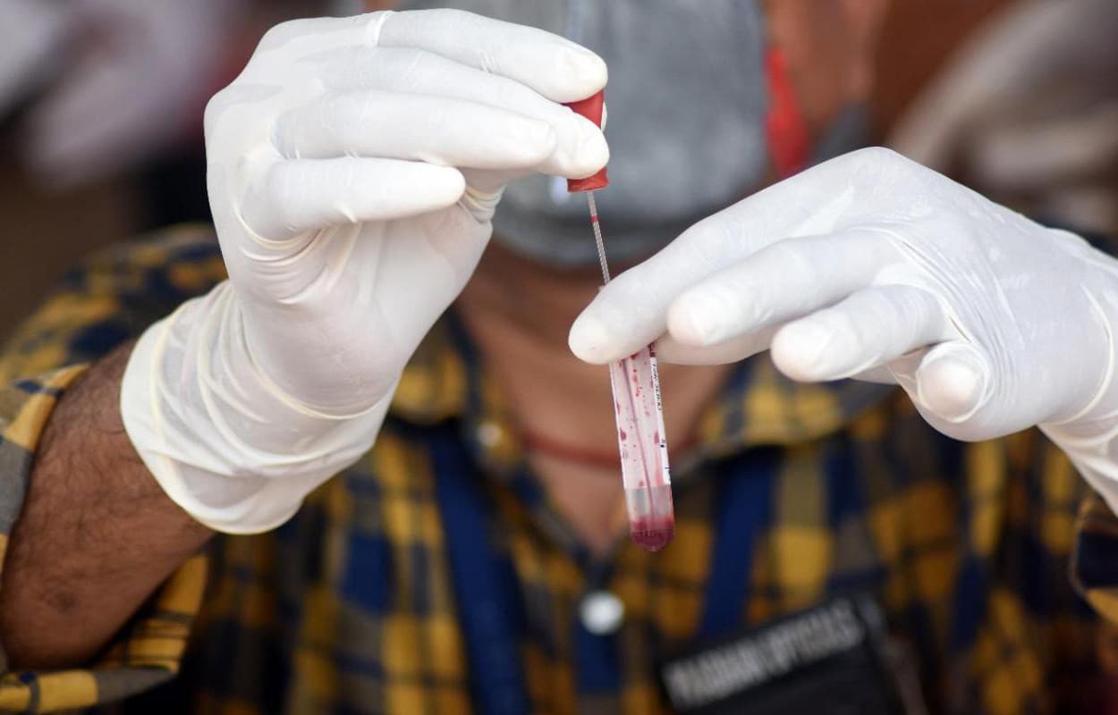 Coronavirus : राज्य में तेजी से बढ़ रहा कोरोना का ग्राफ, 24 घंटे में 2,216 नये मरीज