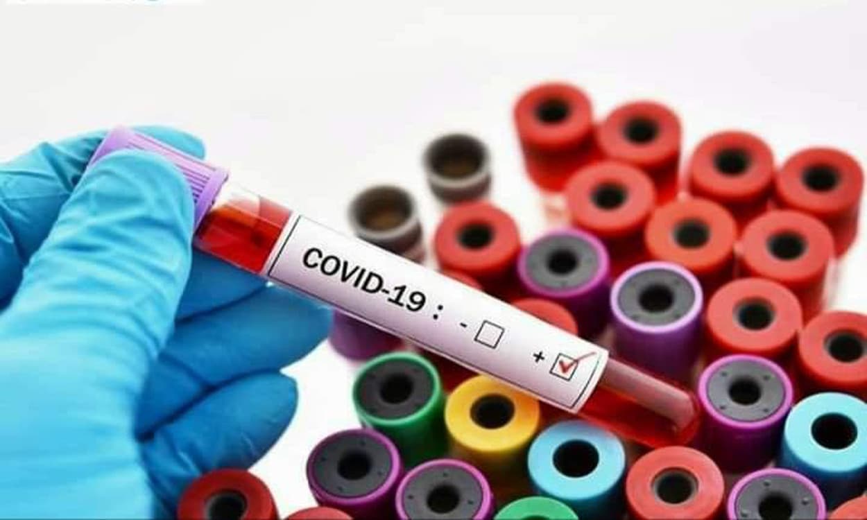Coronavirus in Jharkhand : झारखंड में एक दिन में 1492 नये संक्रमित मिले, 1235 हुए स्वस्थ, रांची में मिले सबसे ज्यादा पॉजिटिव