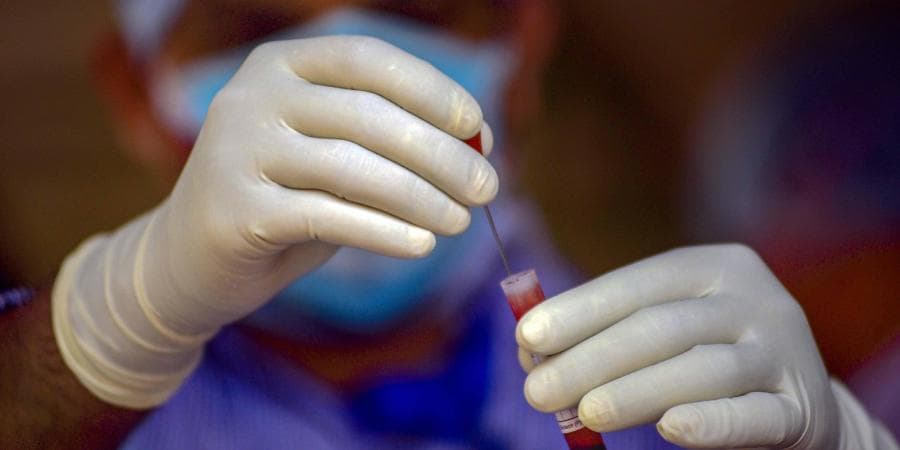 देश में कोरोना ने मचाया कोहराम, 24 घंटे में 3.80 लाख से ज्यादा नए मामले, जानिए अबतक कोरोना से कितने लोगों ने तोड़ा दम