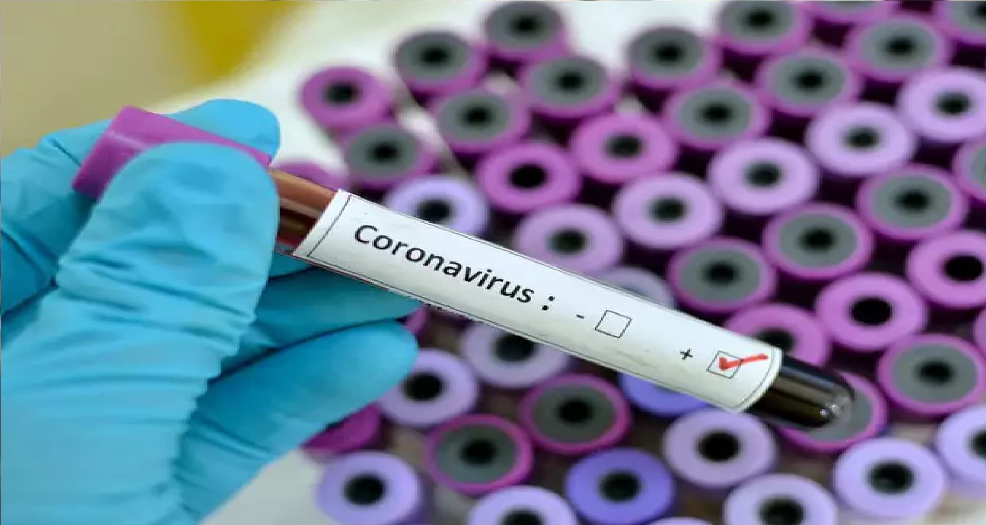 Covid-19: अलीगढ़ में 30 बच्चे कोरोना पॉजिटिव, स्वास्थ्य विभाग ने जारी किया अलर्ट