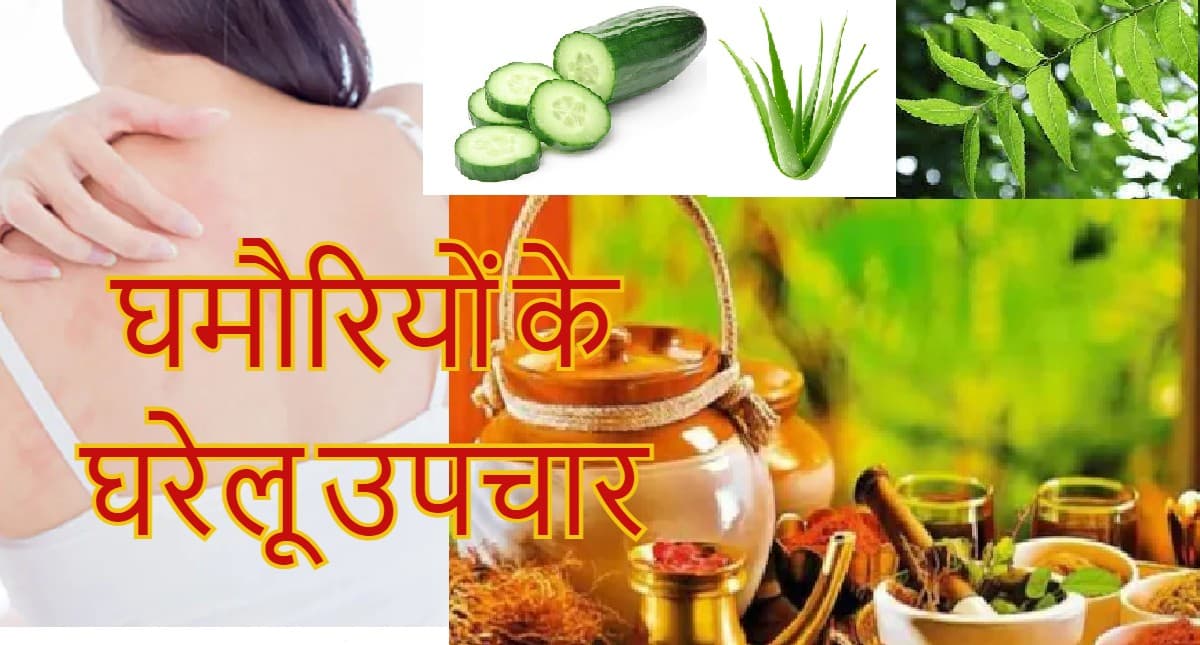 Home Remedies For Prickly Heat: गर्मियों में घमौरियां से परेशान हैं? अपनाएं ये घरेलू उपाय Home Remedies For Prickly Heat: गर्मियों में घमौरियां से परेशान हैं? अपनाएं ये घरेलू उपाय