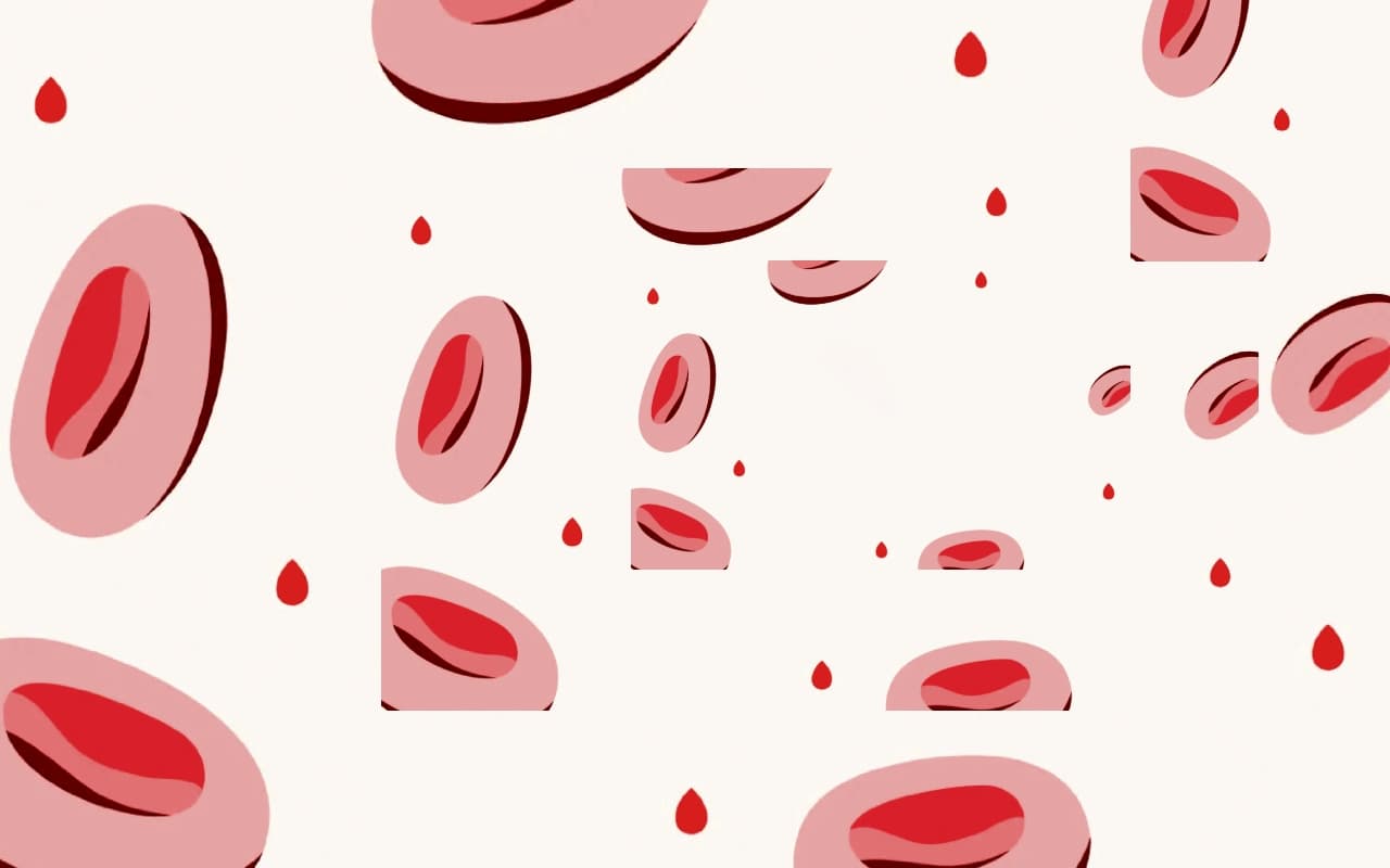 झारखंड में 7 फीसदी आबादी सिकल सेल एनीमिया और थैलेसीमिया से पीड़ित, पायलट प्रोजेक्ट रांची छोड़ अन्य जगहों पर ठप